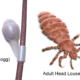 Nit Egg and adult head louse