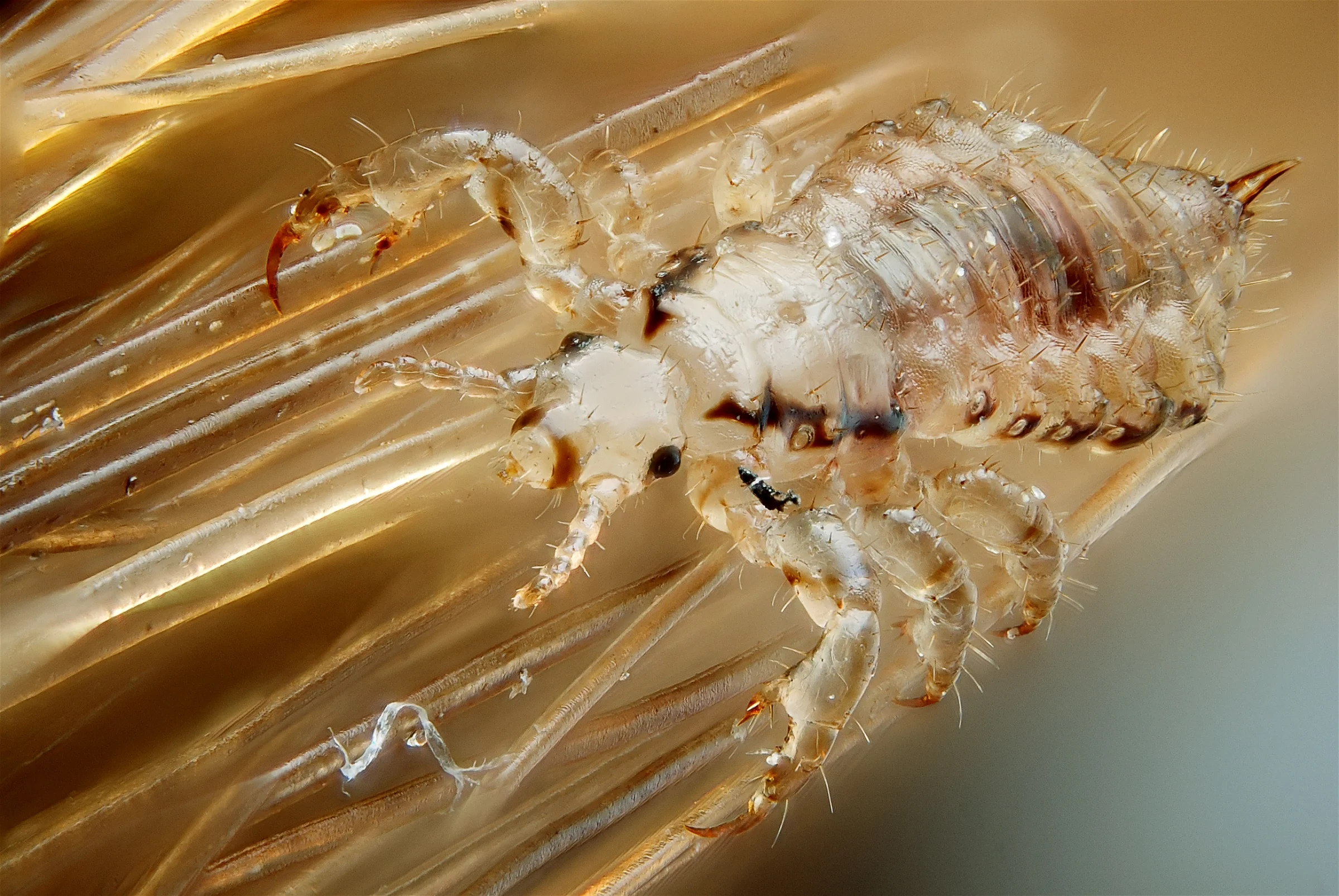 Where Do Head Lice Come From, & How Do You Get Them?